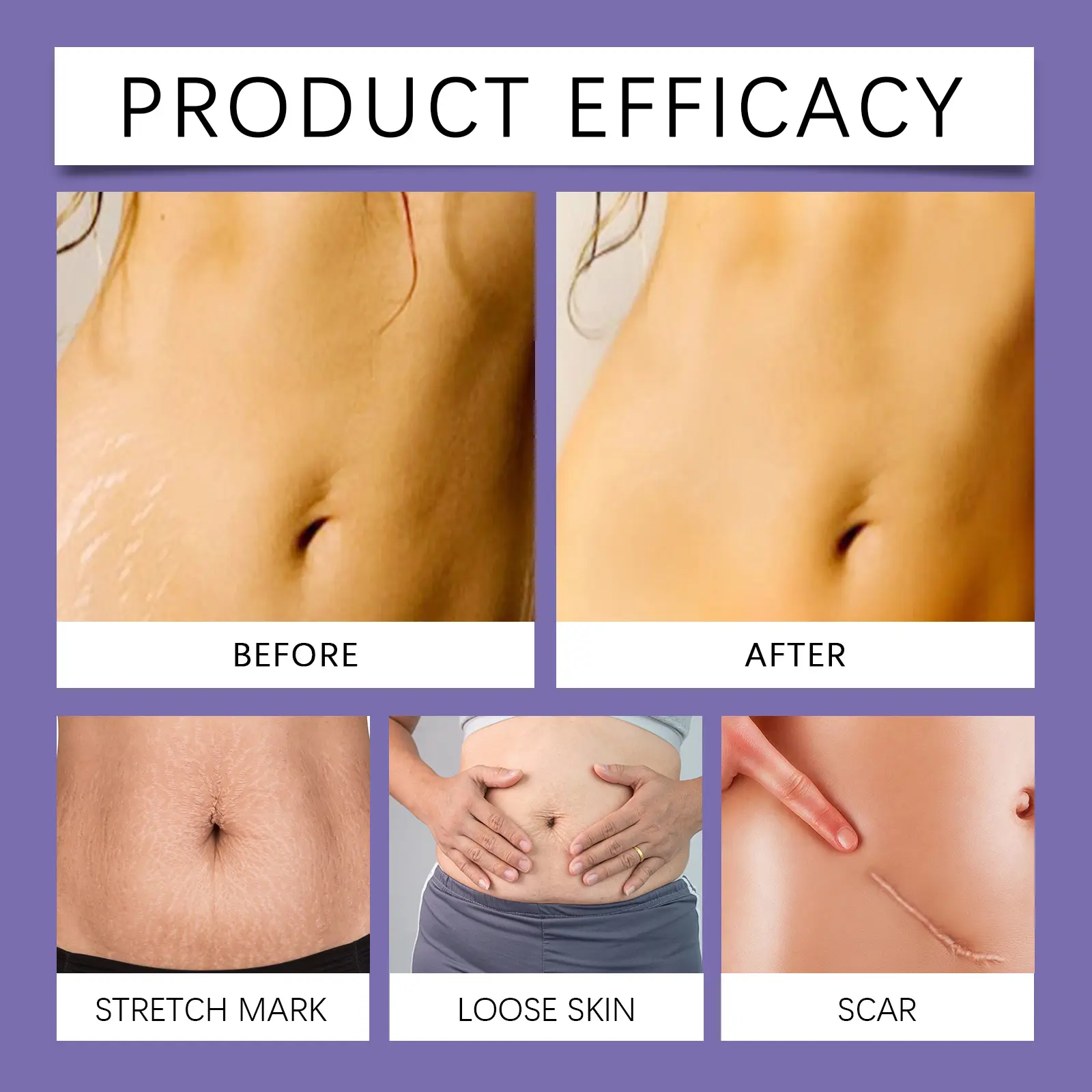 Laniska Body Repair Cream for Women - Skin Elasticity & Moisturizing 12 laniska postpartum repair cream LA A06 0002 01 2867