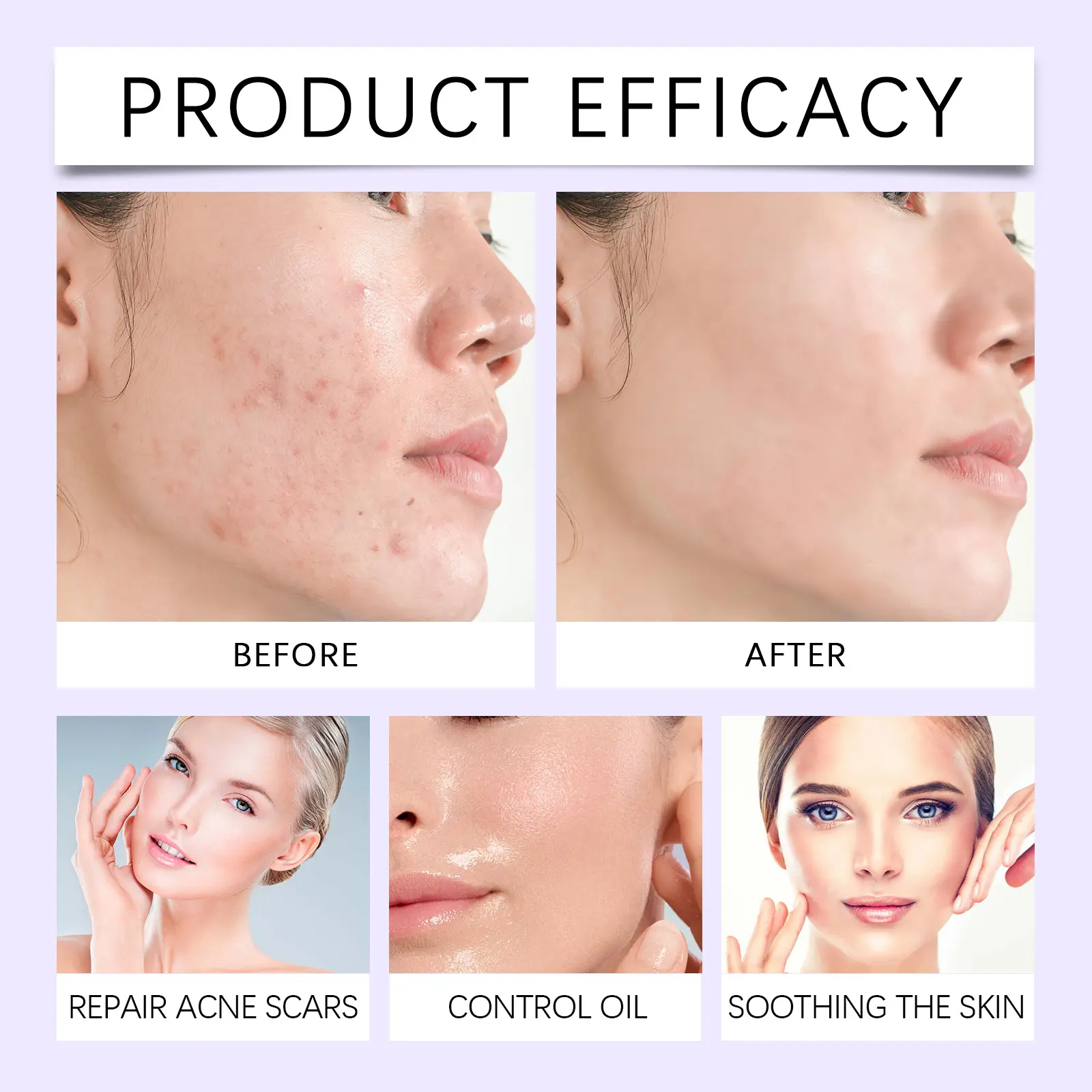 Laniska Propolis Cream with Lavender Oil for Skin Relief 12 laniska propolis cream LA B06 0007 01 3347
