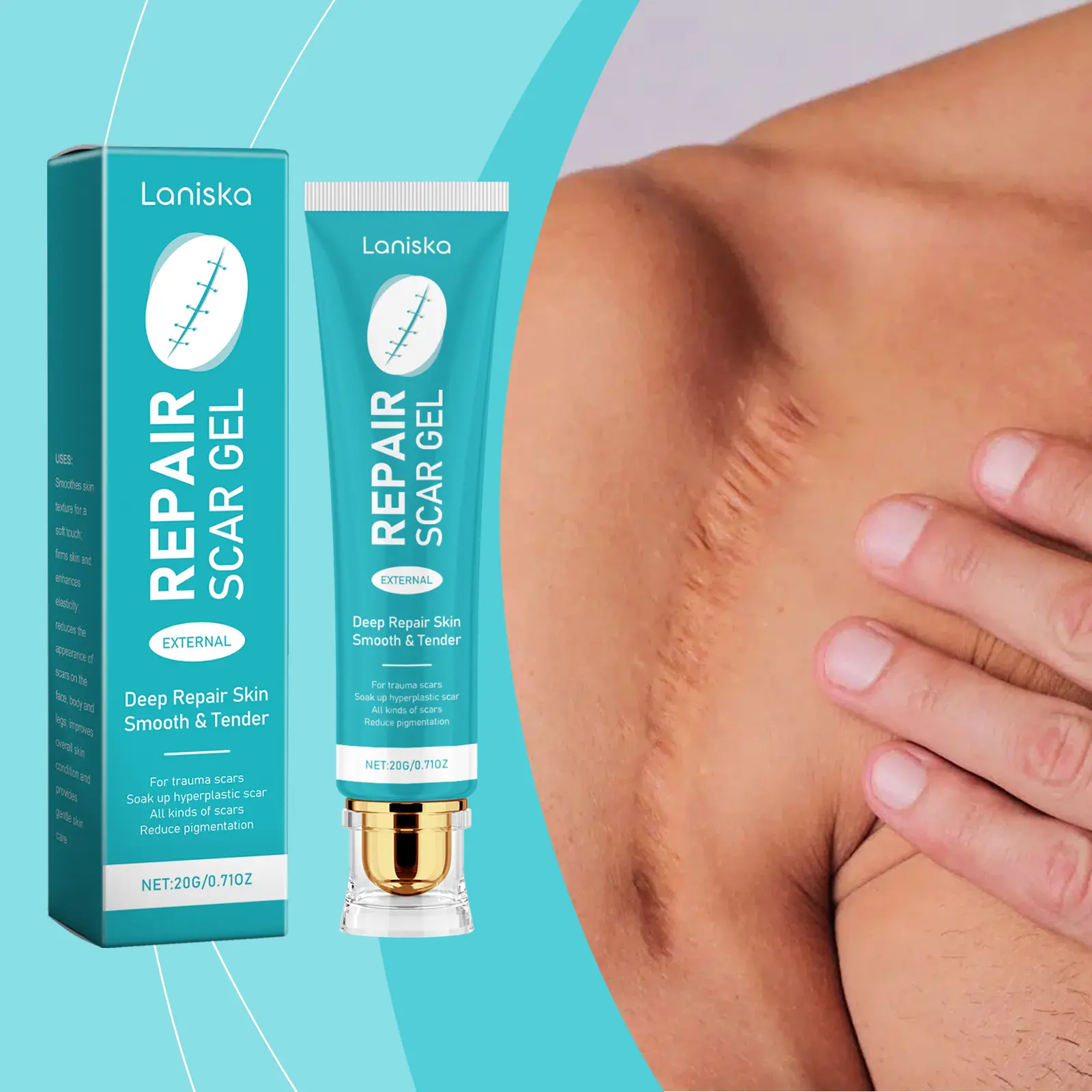 My Honest Laniska Skin Smoothing Gel Review: Does It Work? 2 Applying the Laniska gel to the arm