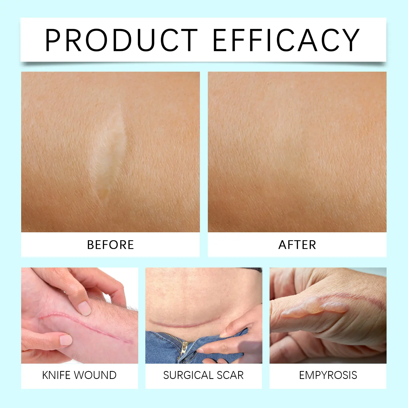 Laniska Skin Smoothing Gel - Firming & Blemish Care for Face and Body 12 laniska skin smoothing gel LA A06 0021 01 1586