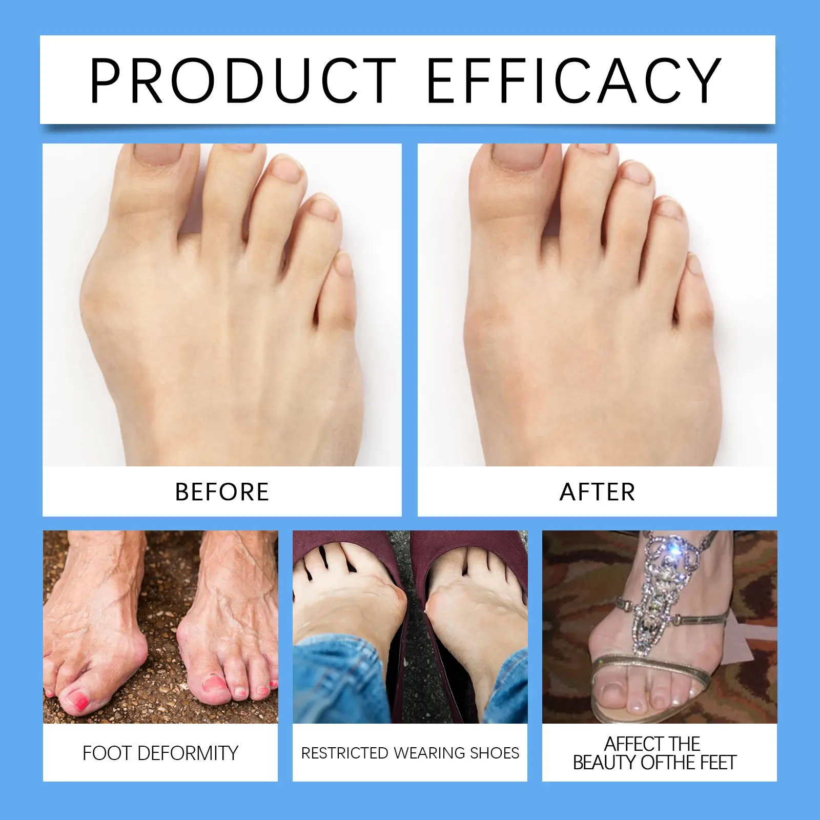 Laniska Toe Joint Care Patch with Wormwood & Licorice Extract 12 laniska toe joint patch LA B05 0005 01 2445